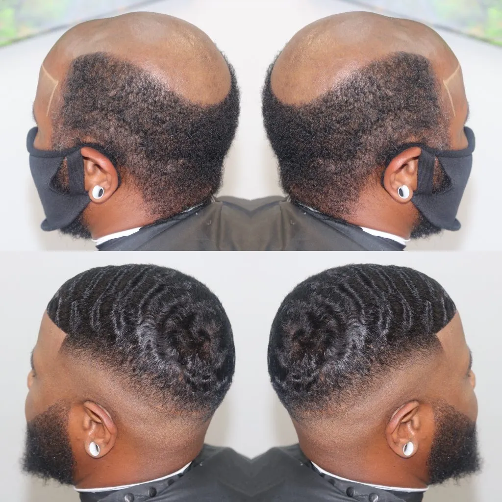 Hair unit Coronavirus