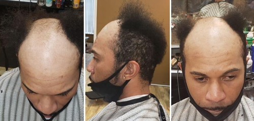 Dallas Man Weave | Get Hair Unit Installation in Dallas Tx