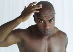 Black man hair loss