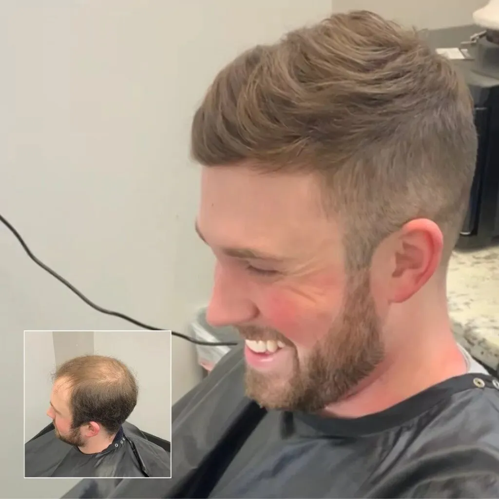 straigt hair, hair system