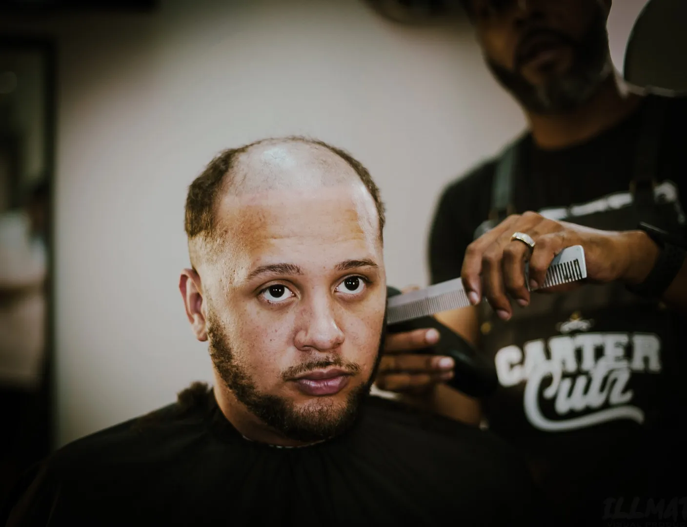 Kristof male pattern baldness