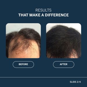 Happy head serum results