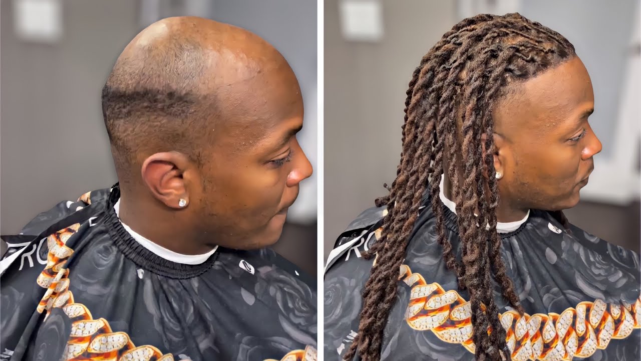 Dreadlock hair system result — long locs before and after — Ace Man Weave Units