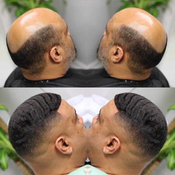 Hair replacement specialist fitting a man weave unit in Boston